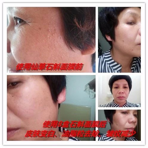 石斛仙草蚕丝面膜,仙草石斛焕颜活肤面膜