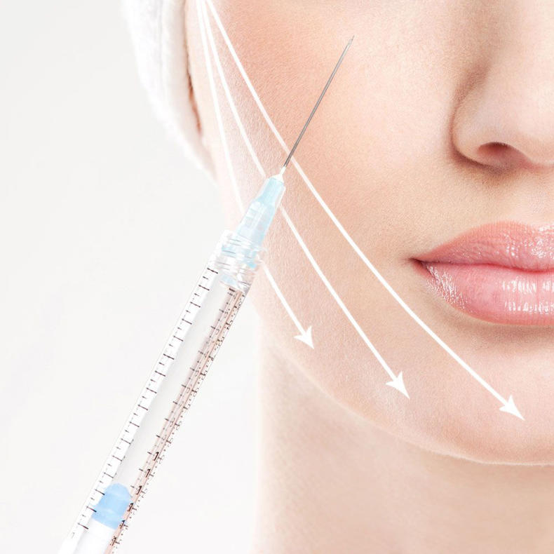 林允有没有鱼尾纹,林允法令纹