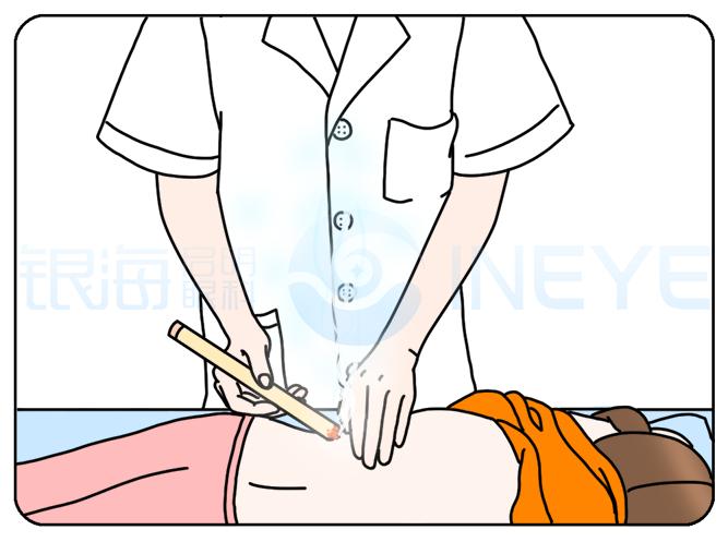 中医适宜技术防控儿童青少年近视,中医外治法治疗青少年近视