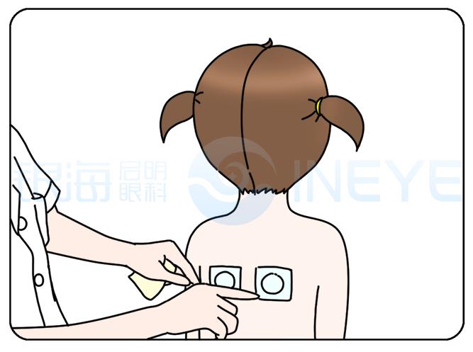 中医适宜技术防控儿童青少年近视,中医外治法治疗青少年近视