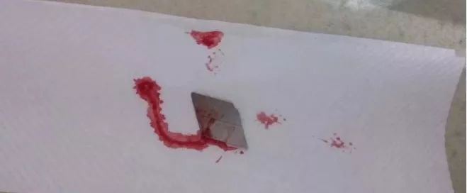 疼死了！青岛10个月大婴儿吞下一个刀片，锋利的美工刀啊！妈妈才离开1分钟就出事了……