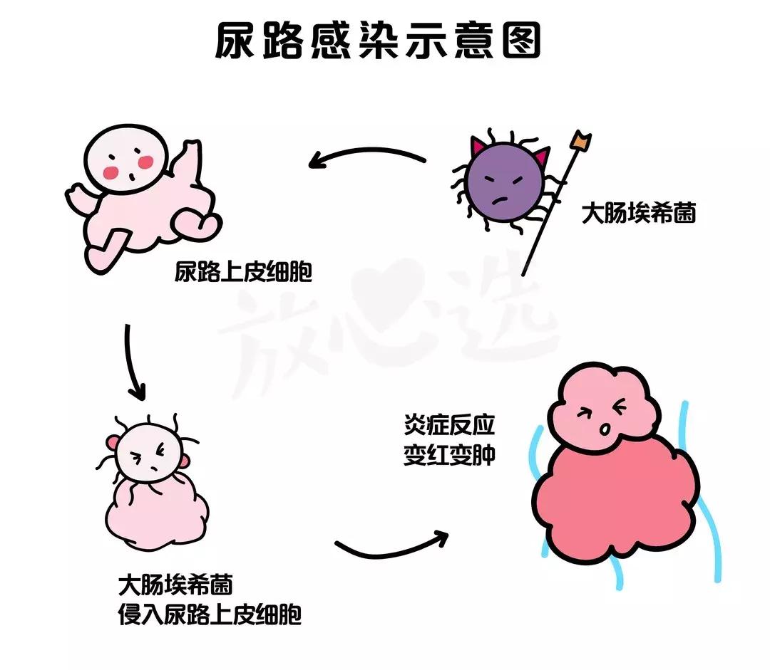 会保养的小姐姐,长期服用蔓越莓胶囊好不好呀