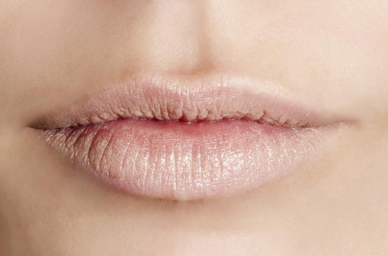 唇纹唇色去除方法有哪些,唇纹唇色深怎么去除