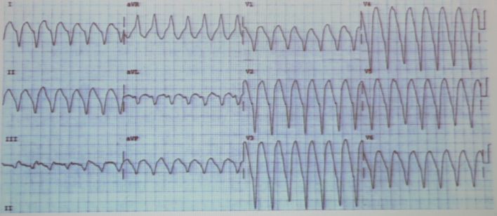 「CHC2018」郭继鸿：心电学进展2018