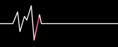 踢球猝死该怎么处理,踢球猝死或病危的案例