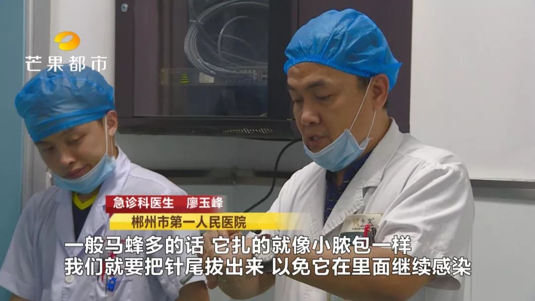 被咕噜蜂蜇住怎么办,外出遇到野蜂蜇人怎么办