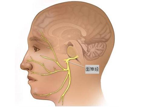 肉毒素治疗面肌痉挛操作视频,肉毒素治疗面肌痉挛的疗效如何