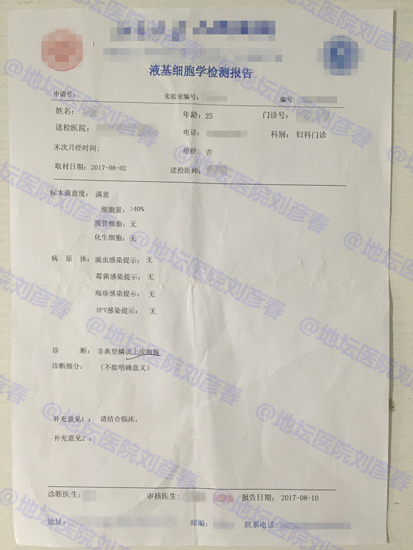 tct查出ascus的检出率高吗,宫颈tct结果ascus什么意思