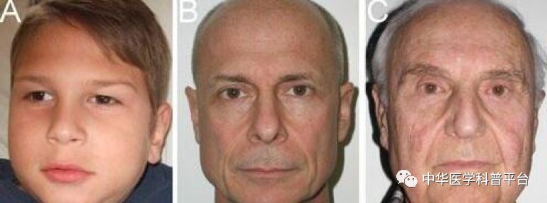 美容整形怎么将脸变小,整形脸为什么会变僵