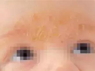 宝宝身上一大片的包是怎么回事,宝宝身上好多片包