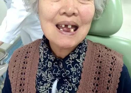 速看！刚刚发布大消息！8月起牙齿矫正、种植牙这10项费用全免！