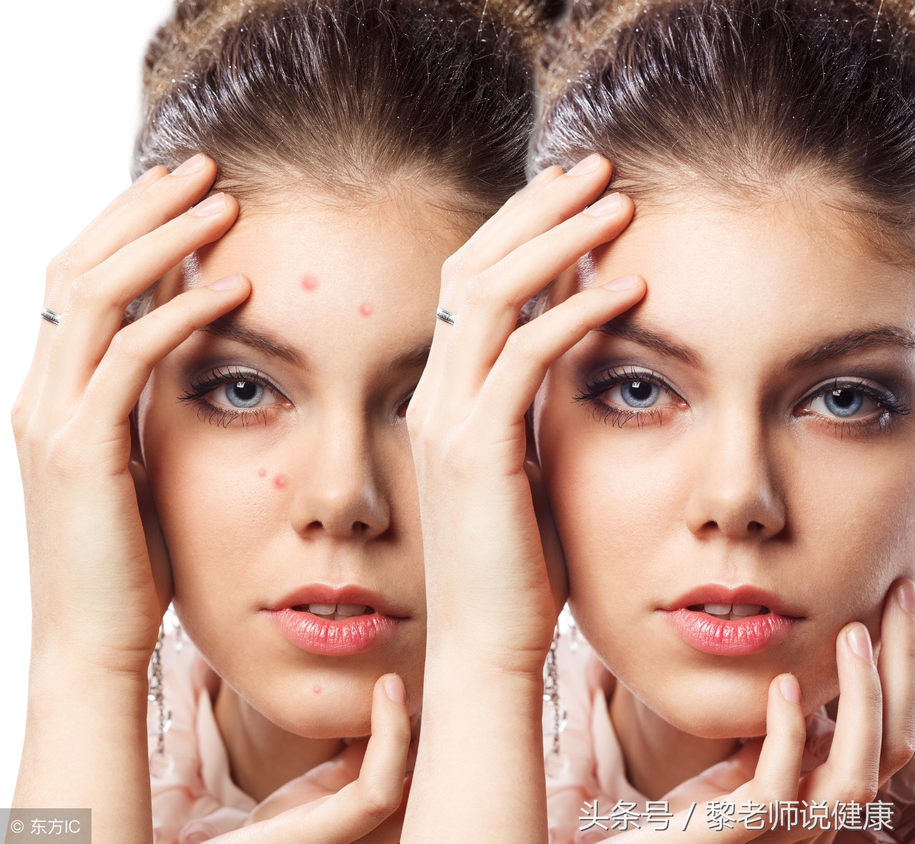 脸上长痘怎样排毒最有效的方法,脸上出油长痘痘用什么药祛痘