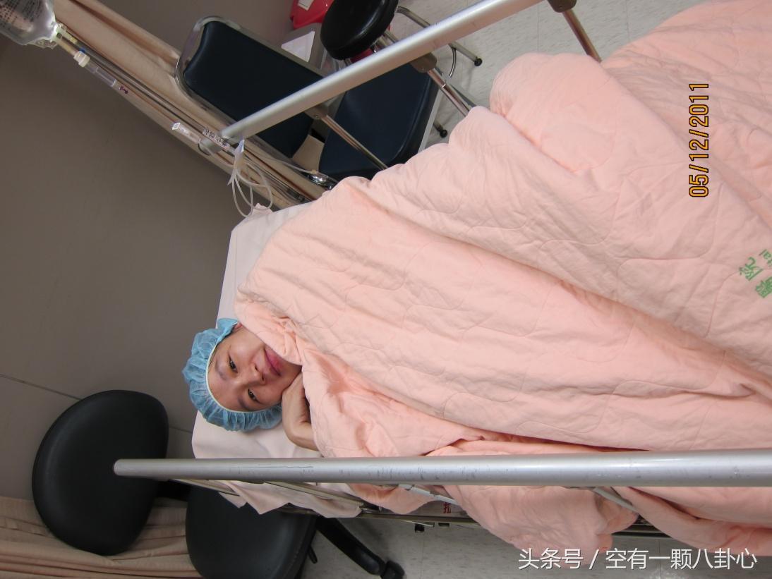 产前选项有什么重要性,产前好还是产后好