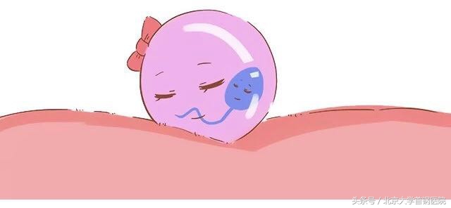 迟迟不来定居点儿的受精卵酿大祸——宫外孕病因篇