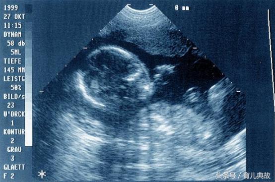 怀孕5个月了还是没胃口反胃,怀孕5周都没胃口