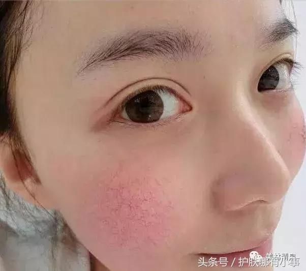 德妃紫苏水中的成分,德妃紫苏水乳到底是保湿还是控油