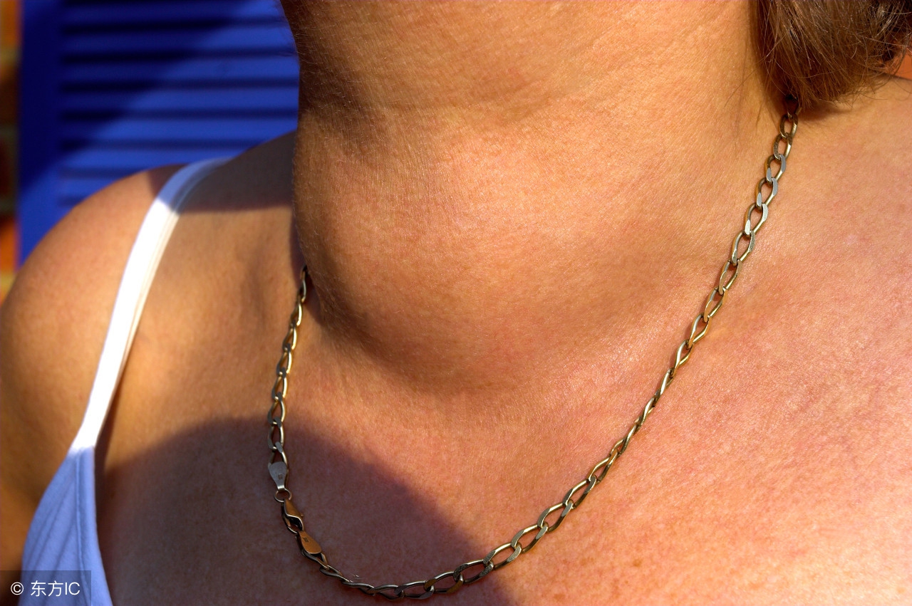 甲状腺ft3低ft4正常说明什么情况,甲状腺功能ft3ft4偏低什么原因