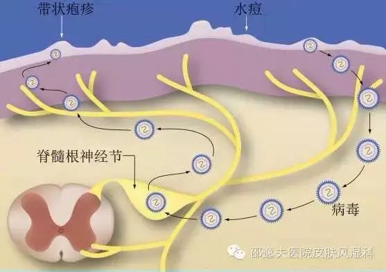 常见的红色疹子,红疹最简单自愈方法