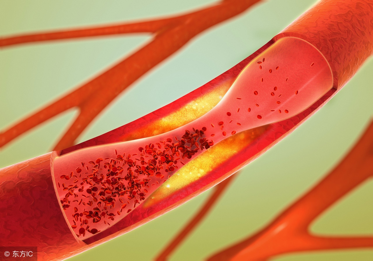 耳鸣怎么办6种方法轻松对付耳鸣,缓解耳鸣症状的4个方法