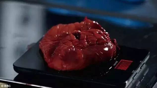 BBC解剖了一个200斤的女胖子，看完瑟瑟发抖！