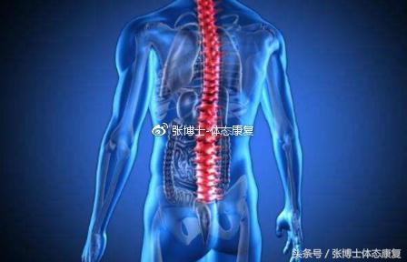 强直性脊柱炎髋关节粘连康复训练,运动疗法强直性脊柱炎研究现状