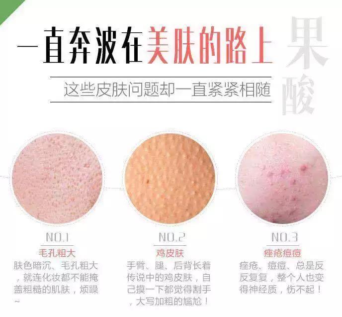 果酸换肤后满满胶原蛋白,果酸换肤烂脸后多久恢复