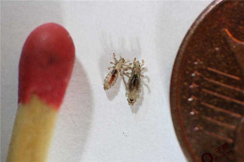 人体的虱子是怎么长出来的,成年后虱子是还会有吗