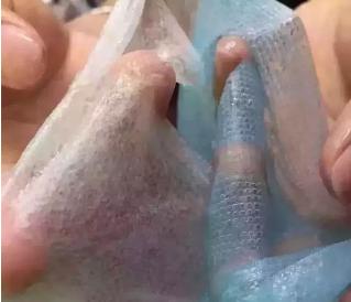 拔草品牌面膜,前几年比较火的微商面膜