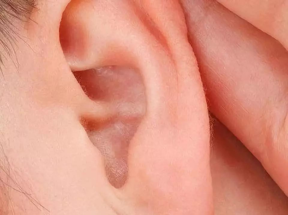 耳屎该不该掏出来,耳屎要不要掏很多人都做错了