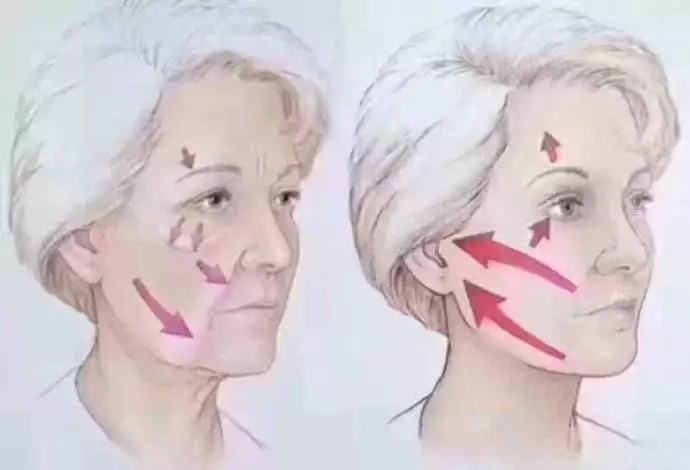 你知道线雕保容颜，却不知道是否适合你？