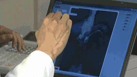 璞嗙摚9.0鎻鍖荤枟榛戝箷,璞嗙摚璇勫垎9.5鐪熷疄浜嬩欢