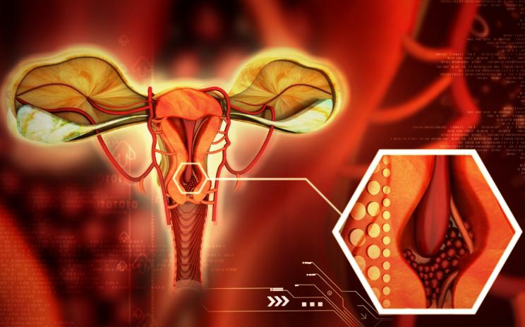 生活不糜烂，却得了宫颈糜烂，问题严重不？