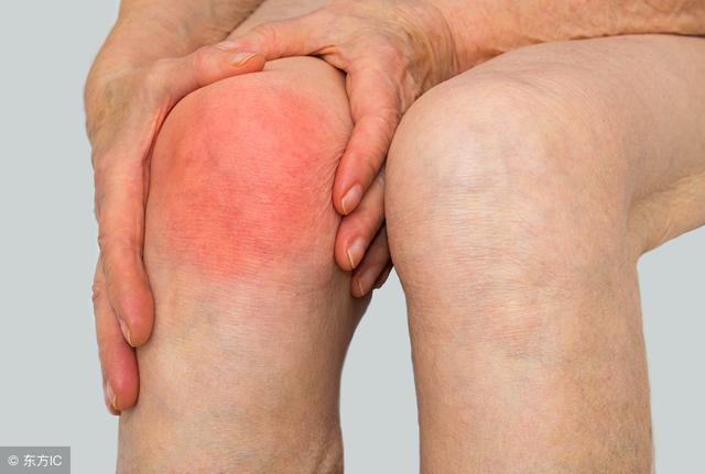 冬病夏治，乡下常见桂树枝，轻松治愈关节炎，错过这次再等一年