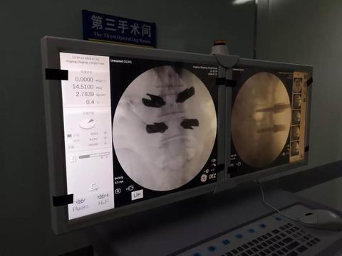 安阳市安钢总医院骨科专家,安钢医院脊柱微创中心主任名单