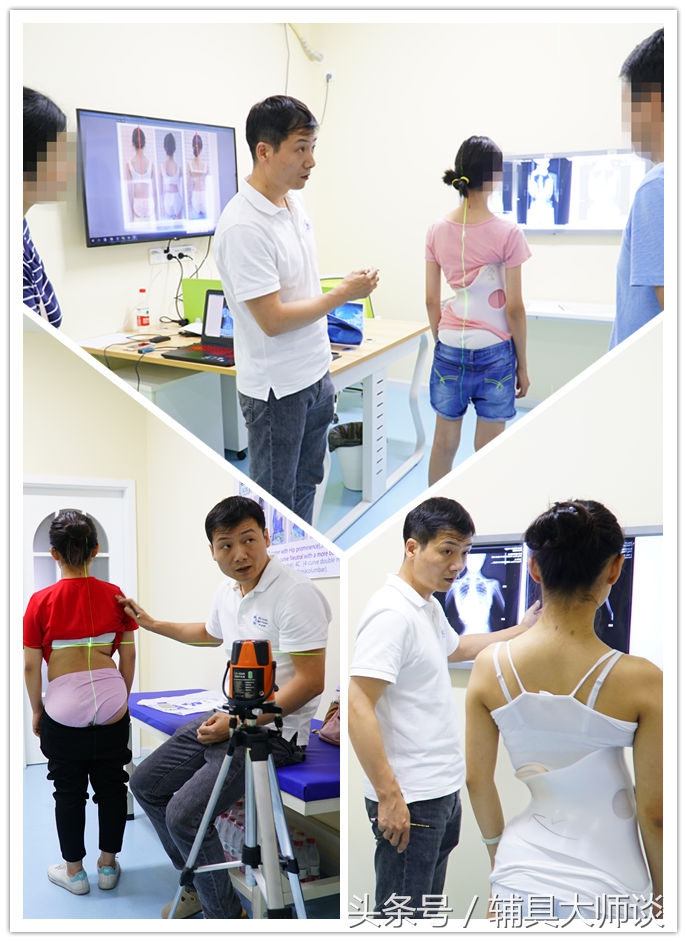 德国gbw支具侧弯60度适合吗,德国gbw支具北京哪里可以订