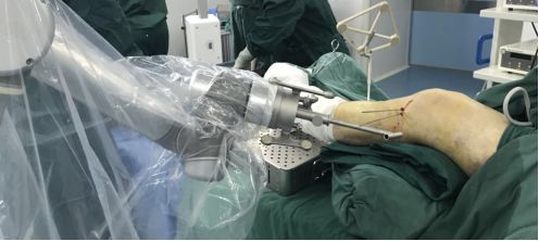 天玑加强版,新一代天玑