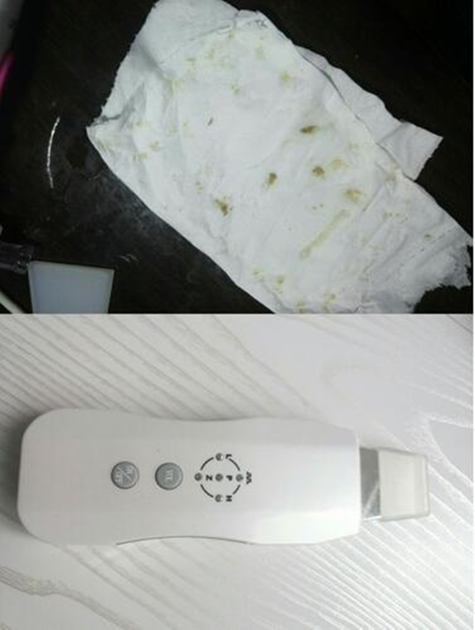 去黑头神器真的能吸出黑头吗,去黑头去痘痘用什么好