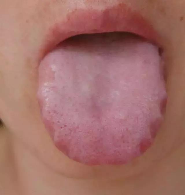 小孩湿气重怎么调理最快,脾胃虚寒湿气重怎么调理炖什么汤