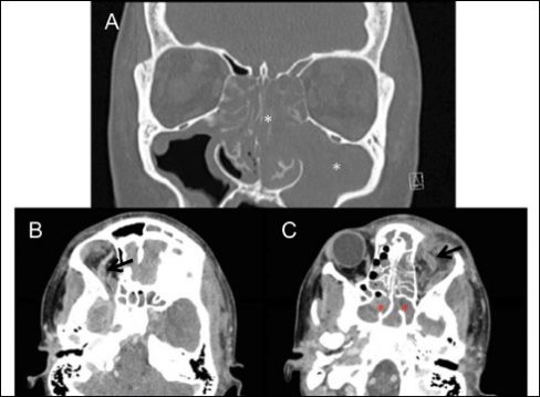 牙疼喉咙疼耳朵疼颈椎疼,小姐姐眼睛疼