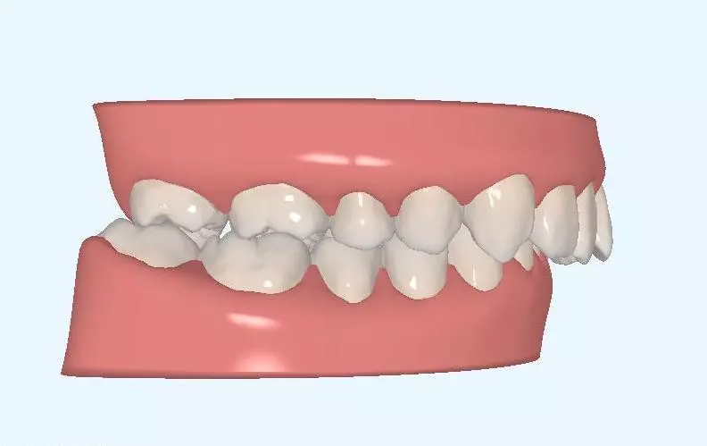 超实用的拔牙小技巧有哪些,拔牙知识图片