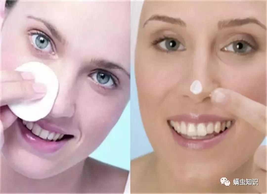 鼻子两侧黑头怎么处理,鼻子上有黑头应该注意些什么