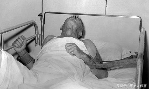 古人被狗咬了怎么处理,古人被狗咬了咋办