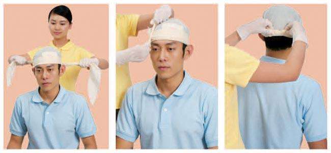 头部外伤容易恢复吗,头部受伤要不要去医院