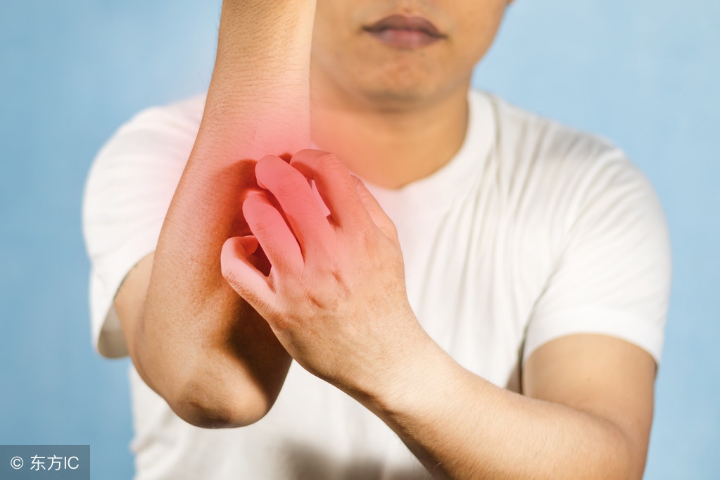 腹股沟湿疹性皮炎怎么治,湿疹脸上大面积发红一般要治多久