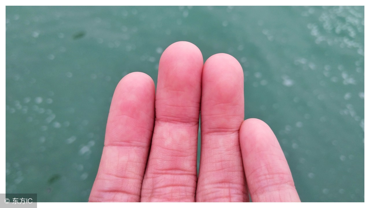 手脚有水泡还瘙痒脱皮,儿童手脚长水泡瘙痒