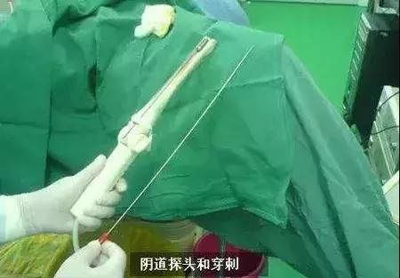 一篇文章带你彻底看懂,一篇文章带你了解真正的全案策划