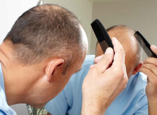 肾虚脱发跟脂溢性脱发有什么区别,怎么判断是肾虚脱发还是雄性脱发