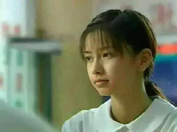 除了发量,最暴露年龄的可能是这两道纹