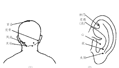中风后遗症推拿,中风推拿治疗思路