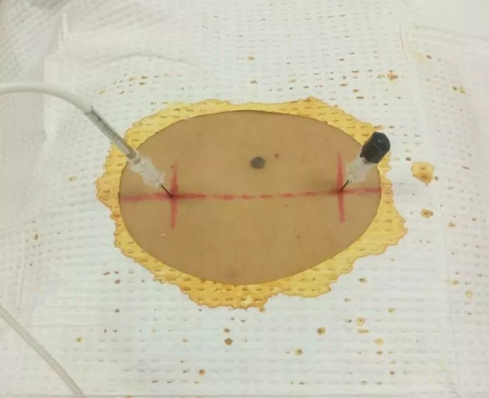 抖腿有啥病,抖腿是一种心理疾病